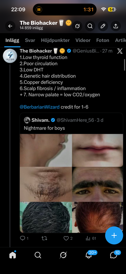NEVER LOSE HAIR AGAIN: Full Head of Hair YOUR WHOLE LIFE