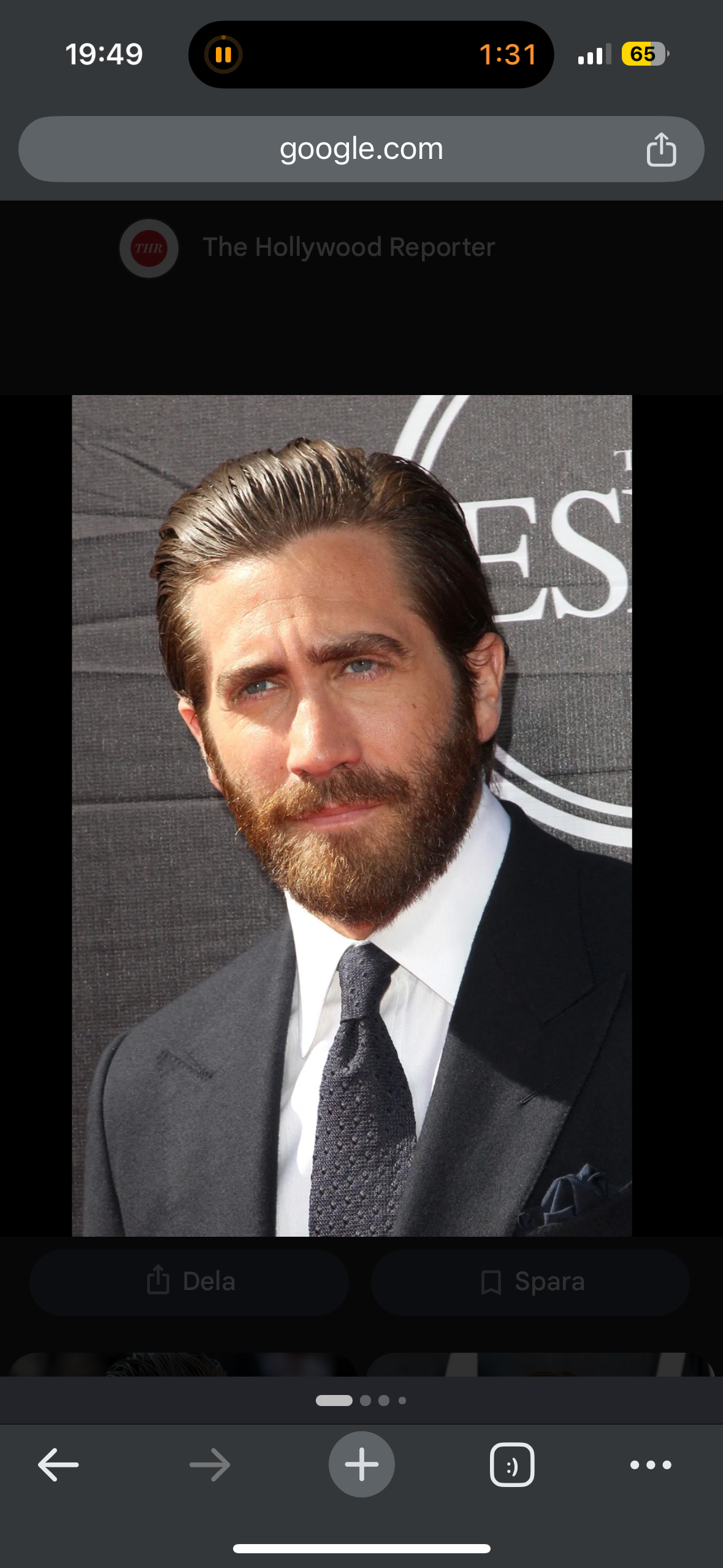 NEVER LOSE HAIR AGAIN: Full Head of Hair YOUR WHOLE LIFE